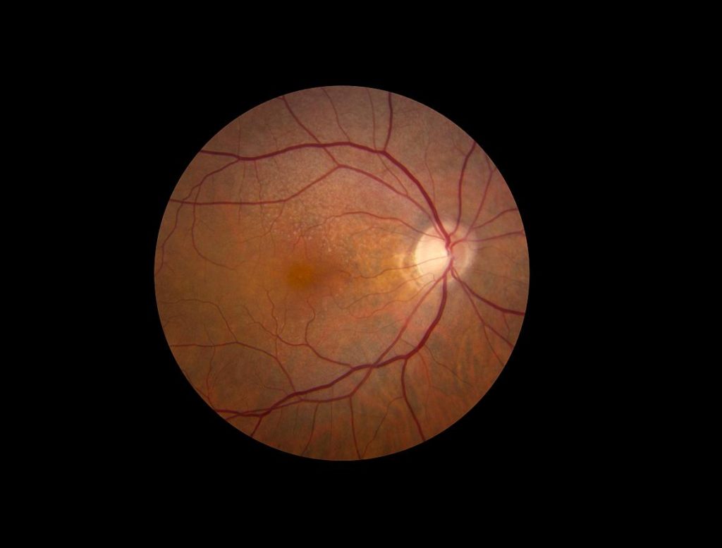 retina