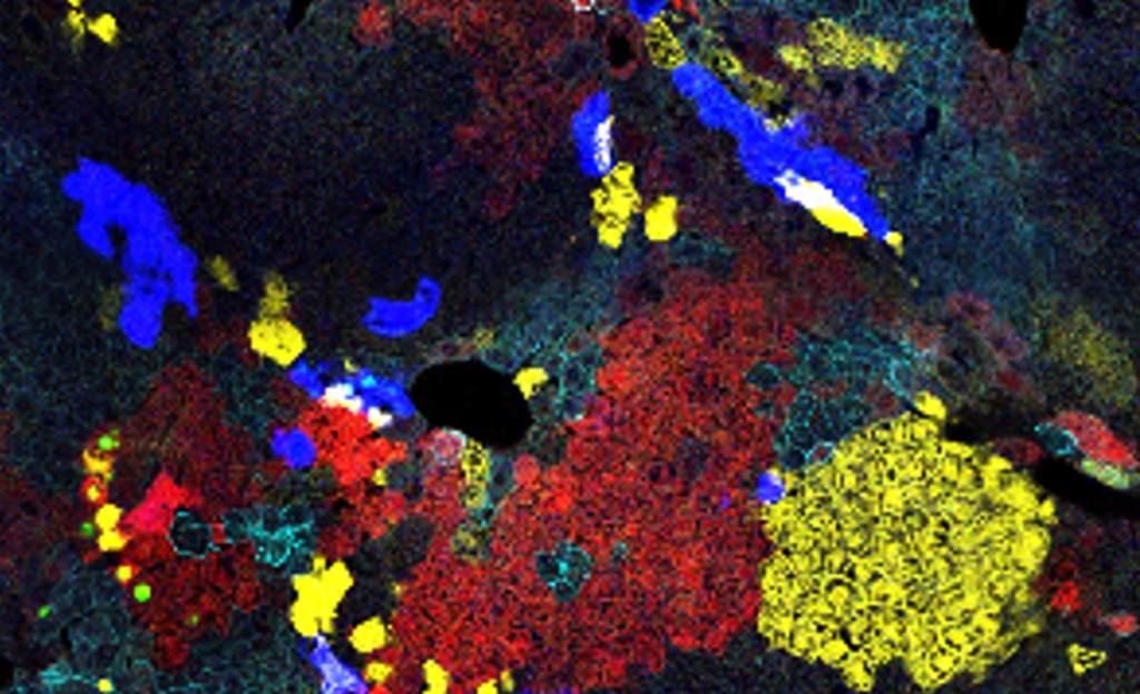 Fluorescence microscopy image of a mouse liver tissue section marked with different fluorescent reporters. Local hepatocyte groups sharing the same reporter are of clonal origin.